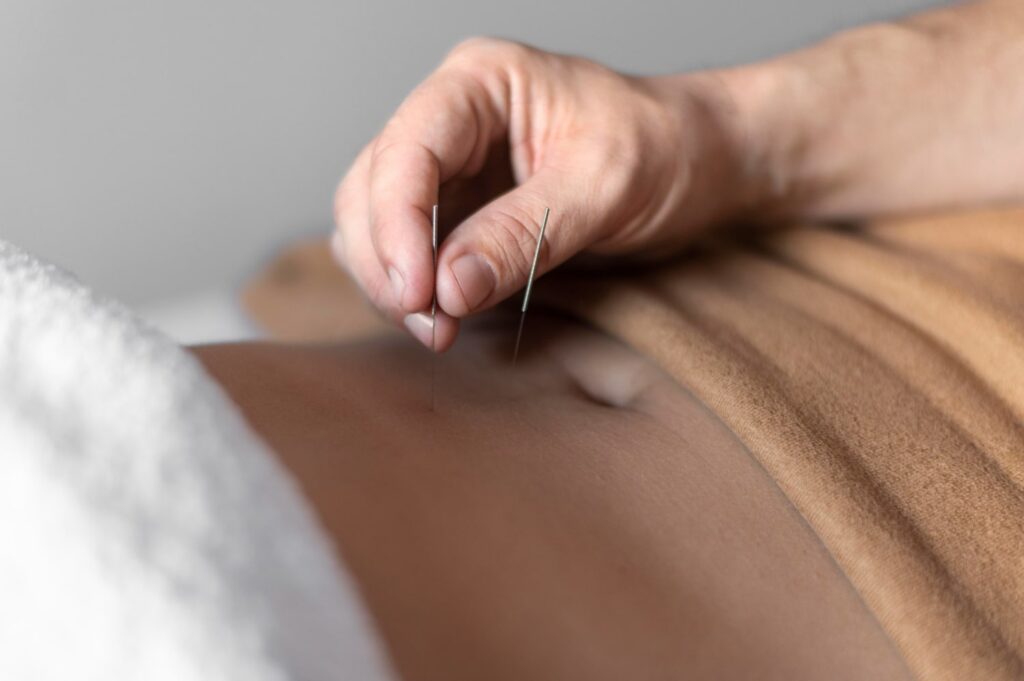 Acupuntura na menopausa: sintomas, evidência e decisões de tratamento