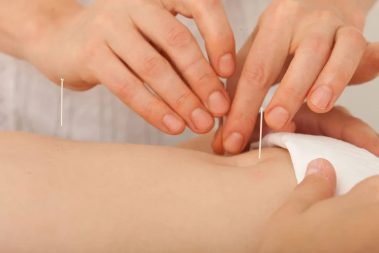 Acupuntura e fertilidade: plano reprodutivo e avaliação médica