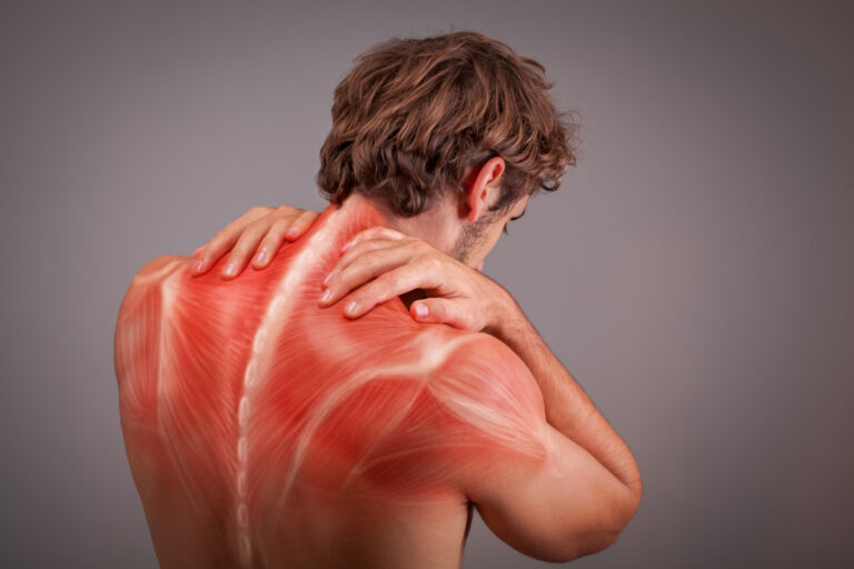 Síndrome Dolorosa Miofascial – Dor Muscular Crônica – Sintomas e Tratamentos