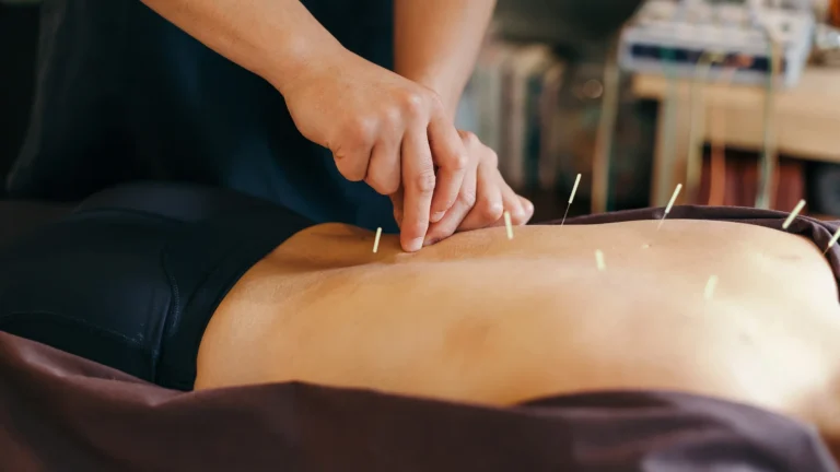 Acupuntura no pós-operatório: recuperação, dor e plano médico
